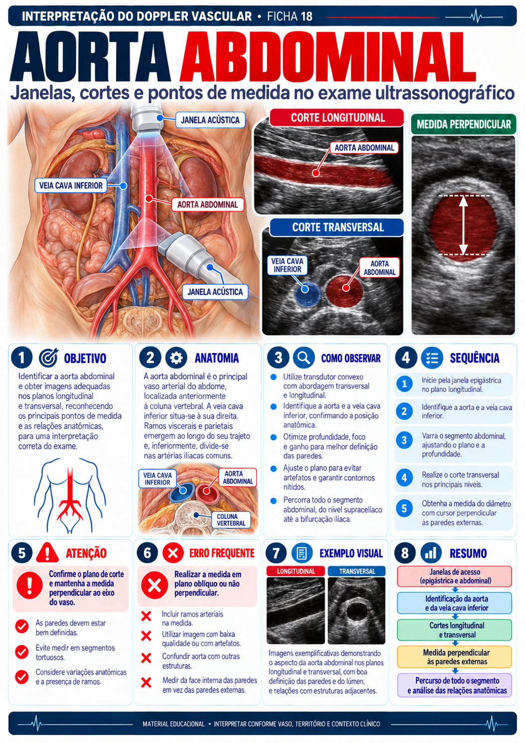 Aorta abdominal